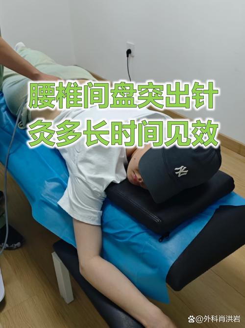 腰椎间盘突出按摩针灸