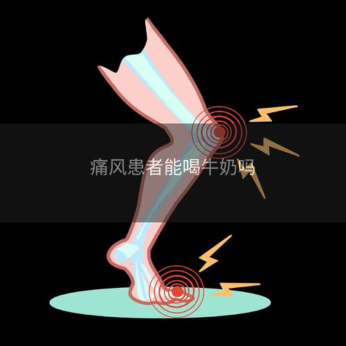 痛风喝酸奶还是纯牛奶