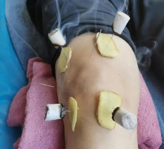 膝盖针灸后可以泡脚吗