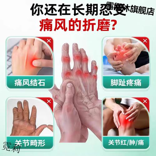 痛风如何溶解尿酸结晶