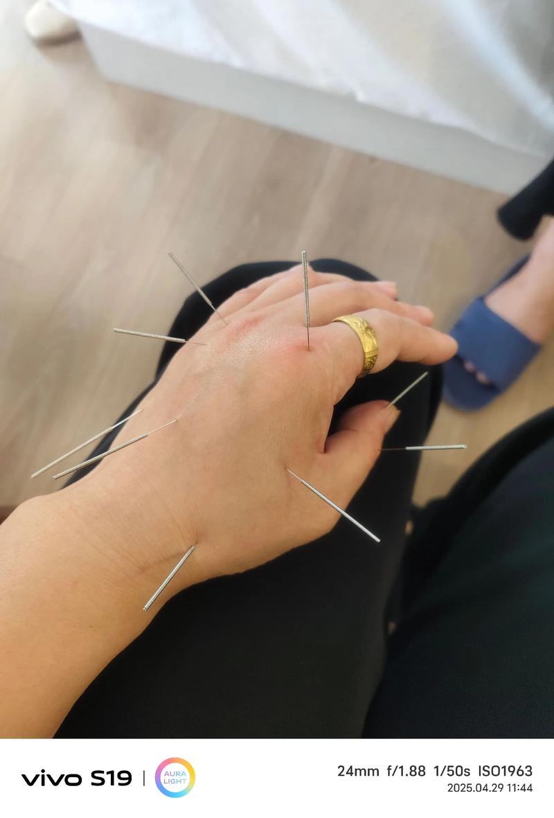 苏州市立医院北区针灸