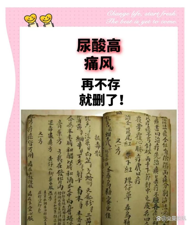 治疗痛风外敷中药配方