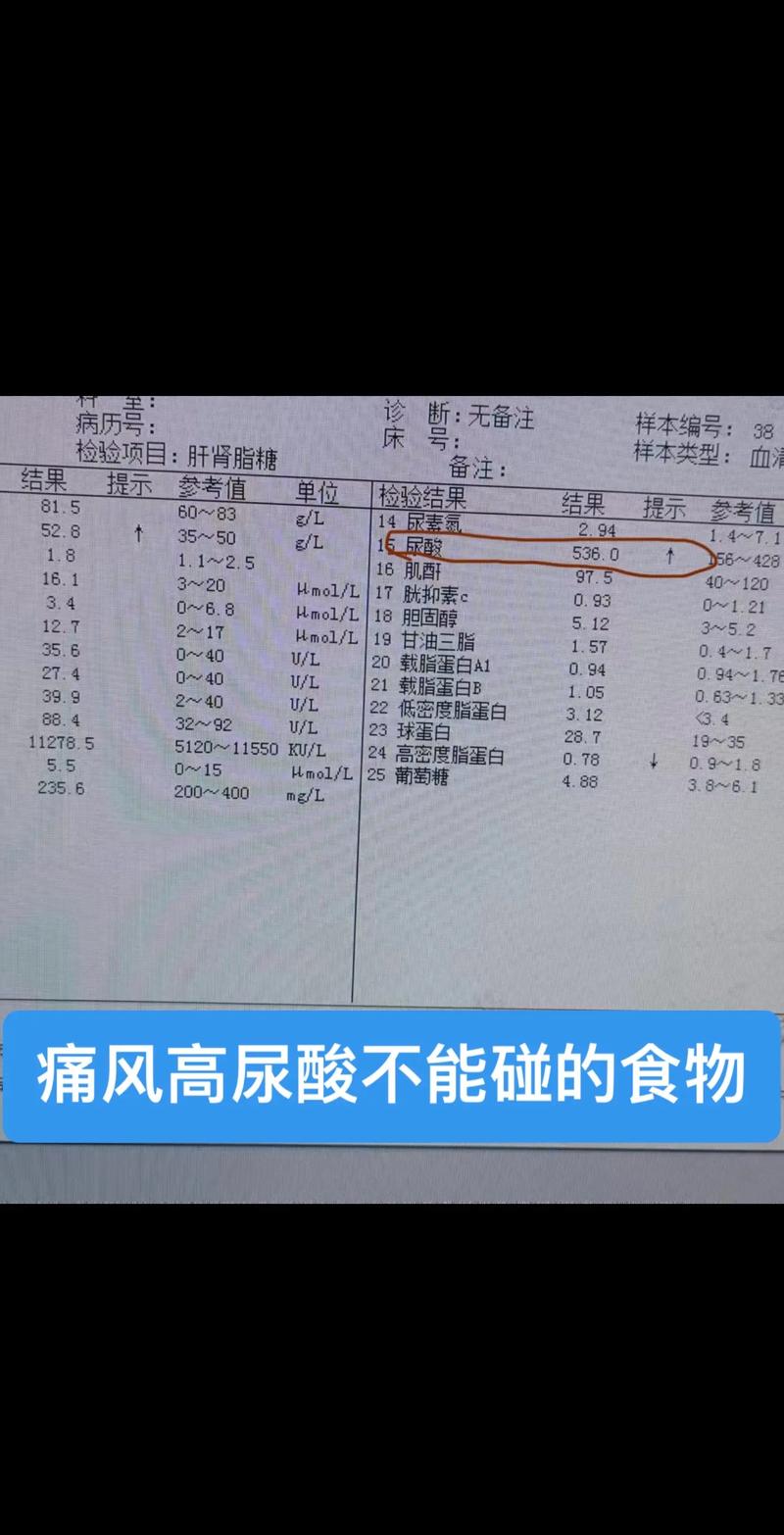 痛风尿酸指标是700