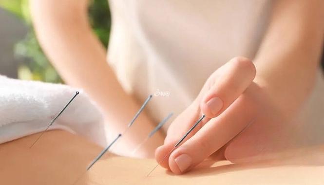 针灸可以降低FSH吗