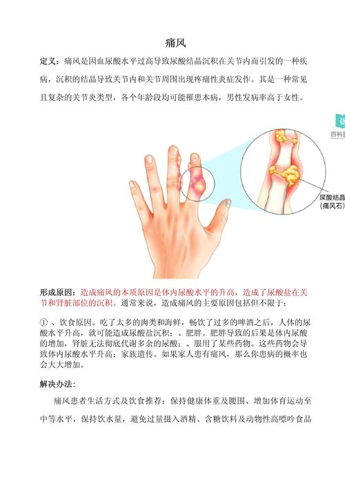 西南医院治疗痛风办法