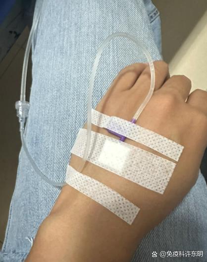 痛风 输液多久才能好