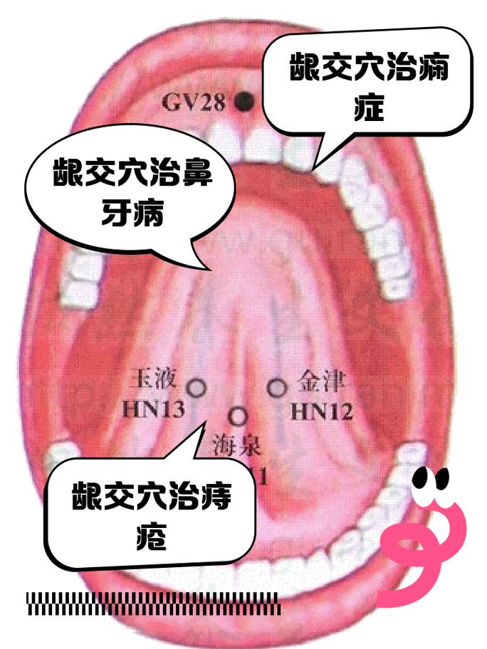 牙疼针灸快速止疼穴位