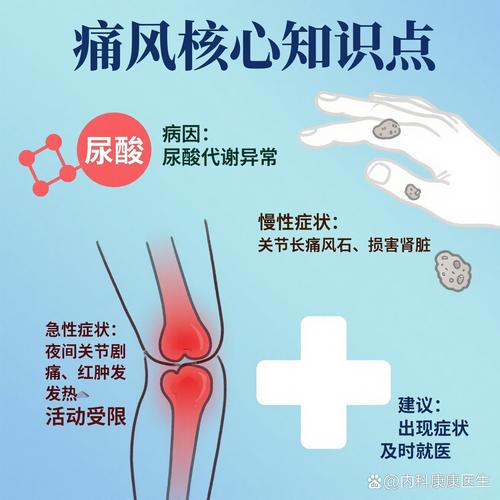 尿酸480多高会痛风