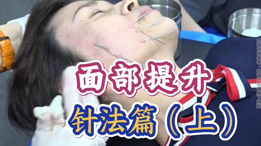 面部针灸常用进针方法