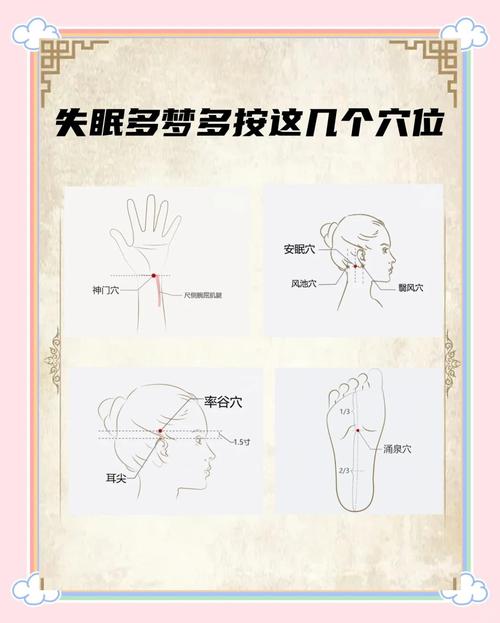 中医针灸治疗失眠穴位