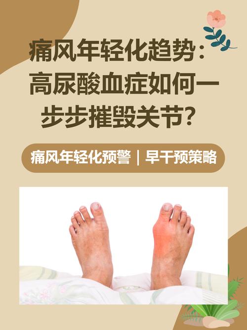 尿酸564 没有痛风