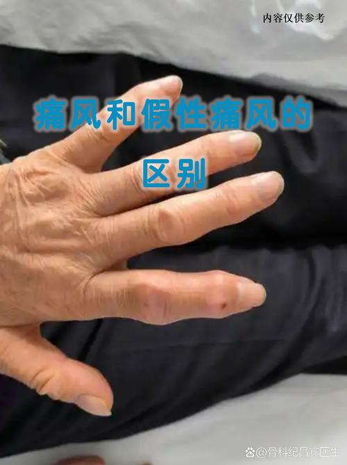 2026东方痛风论坛