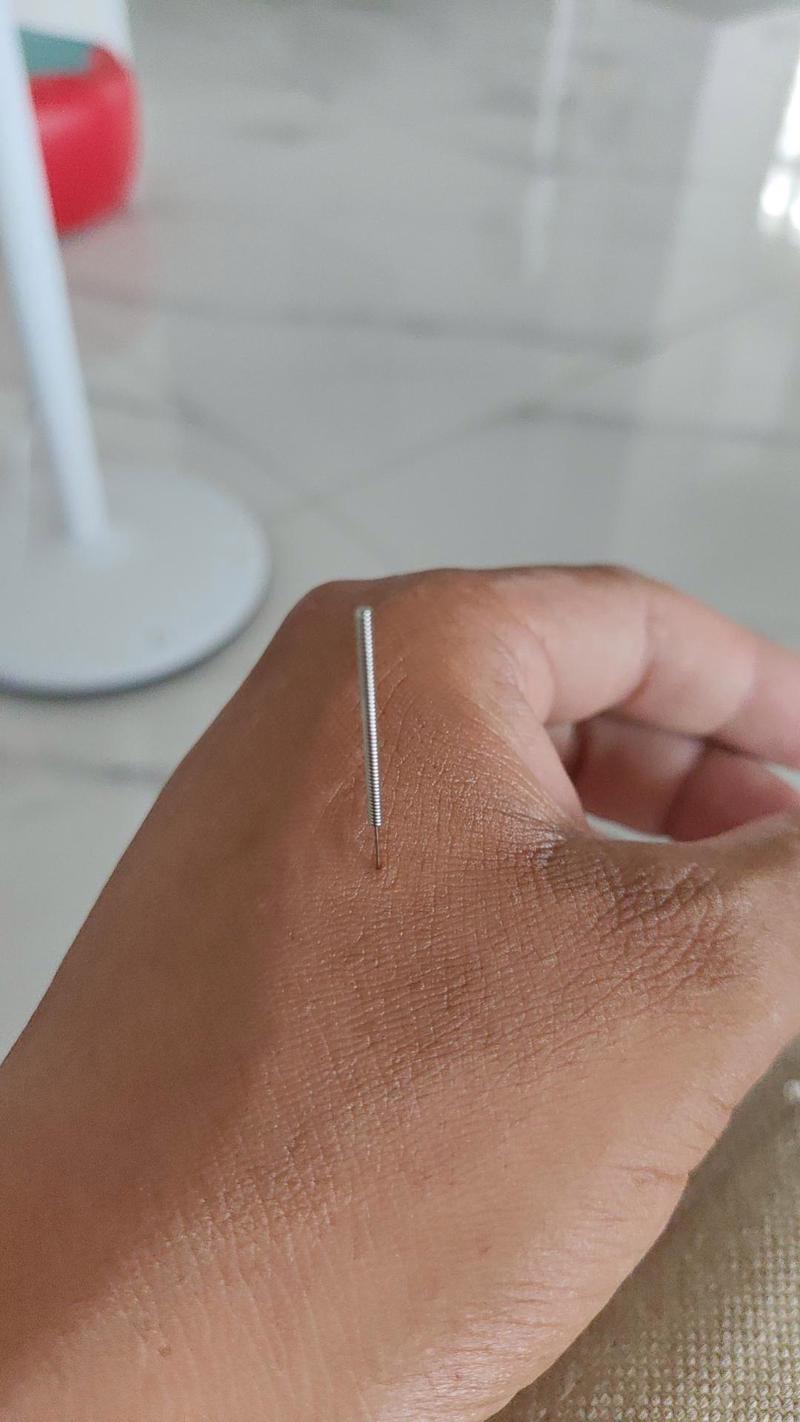 嗓子发炎针灸什么位置