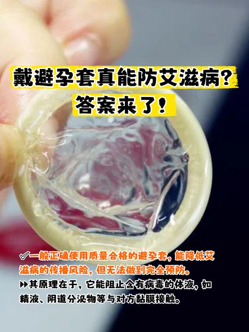 安全套 几率 艾滋病