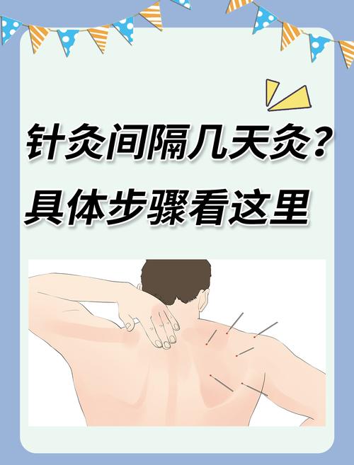 针灸一般留针多长时间