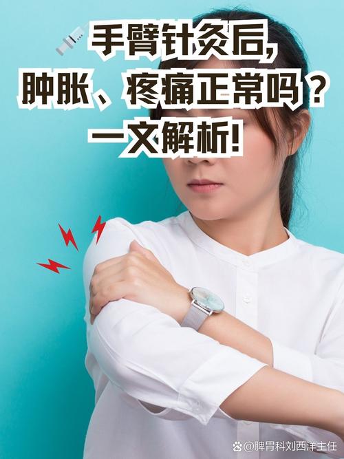 针灸扎完后肿了怎么办