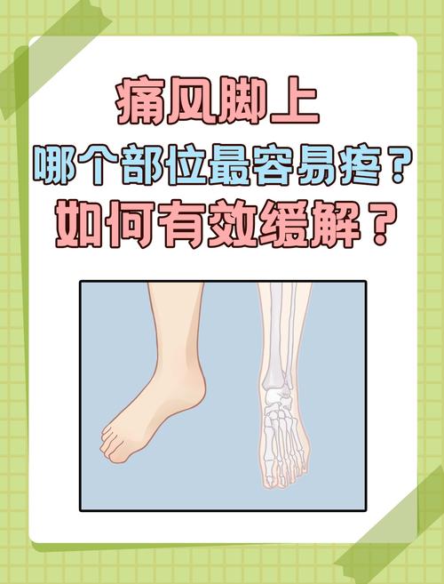 脚不红不肿疼是痛风吗