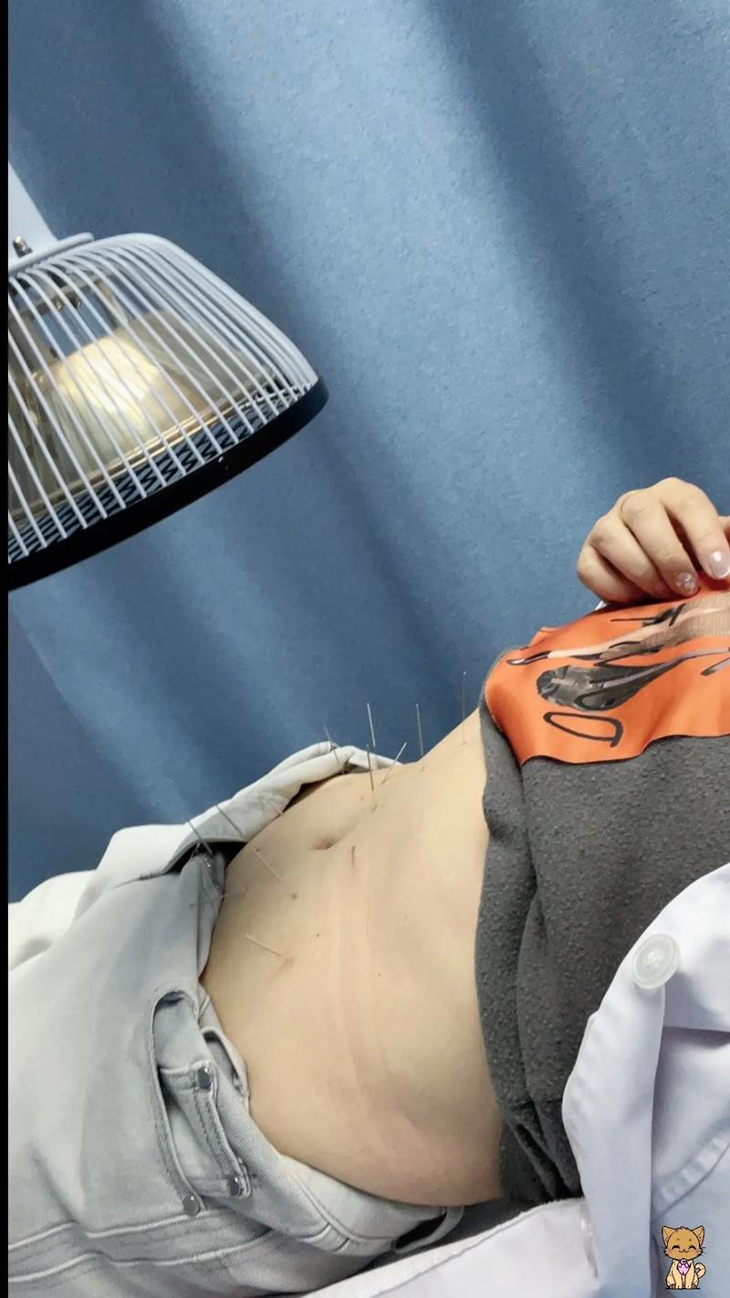 针灸后小腹胀痛怎么办
