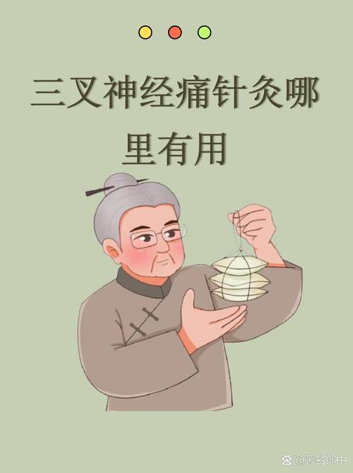 三叉神经针灸能治好吗