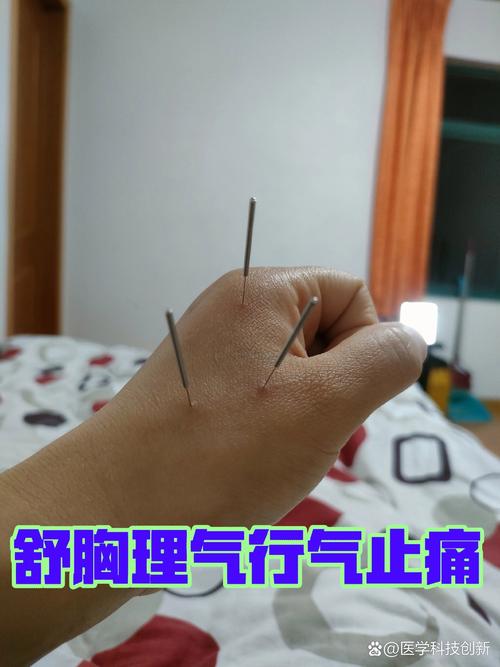 针灸补气血效果怎么样