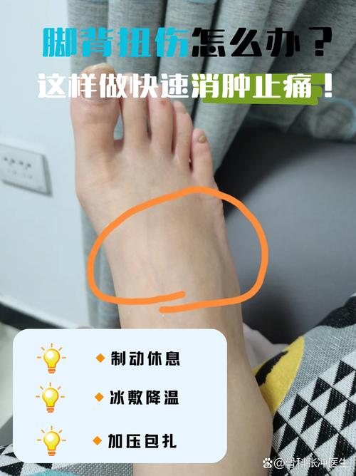 脚背疼是痛风怎么治疗