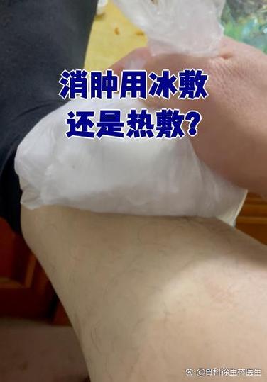 痛风发作冰敷还是热敷