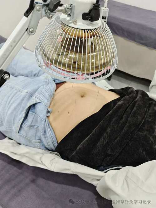 中医院针灸减肥有用吗