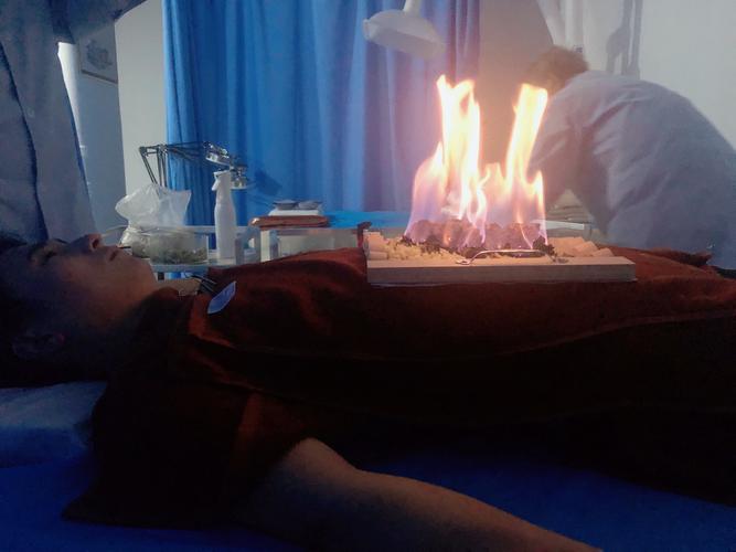 针灸和火疗能同时做吗