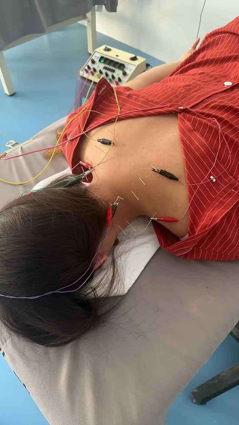 月经期可以针灸颈椎病