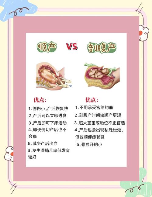 剖腹产与顺产哪个安全