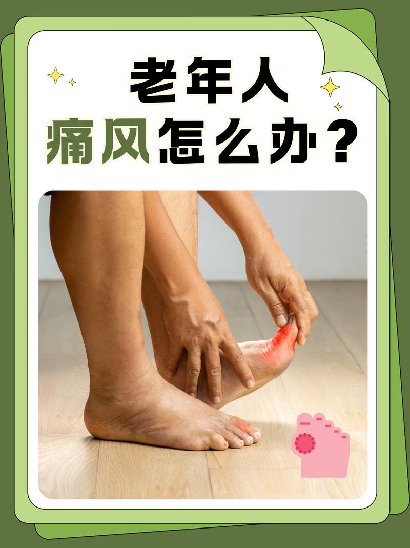 什么样的人容易的痛风