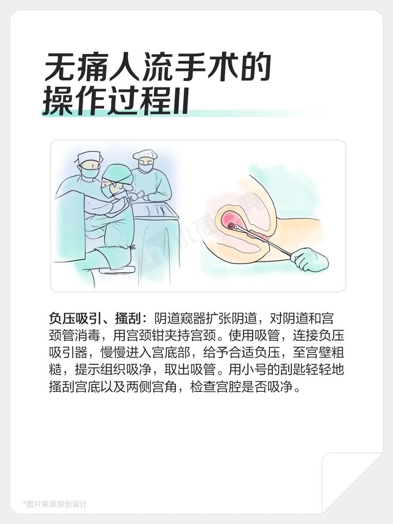 无痛人流哪家做的安全