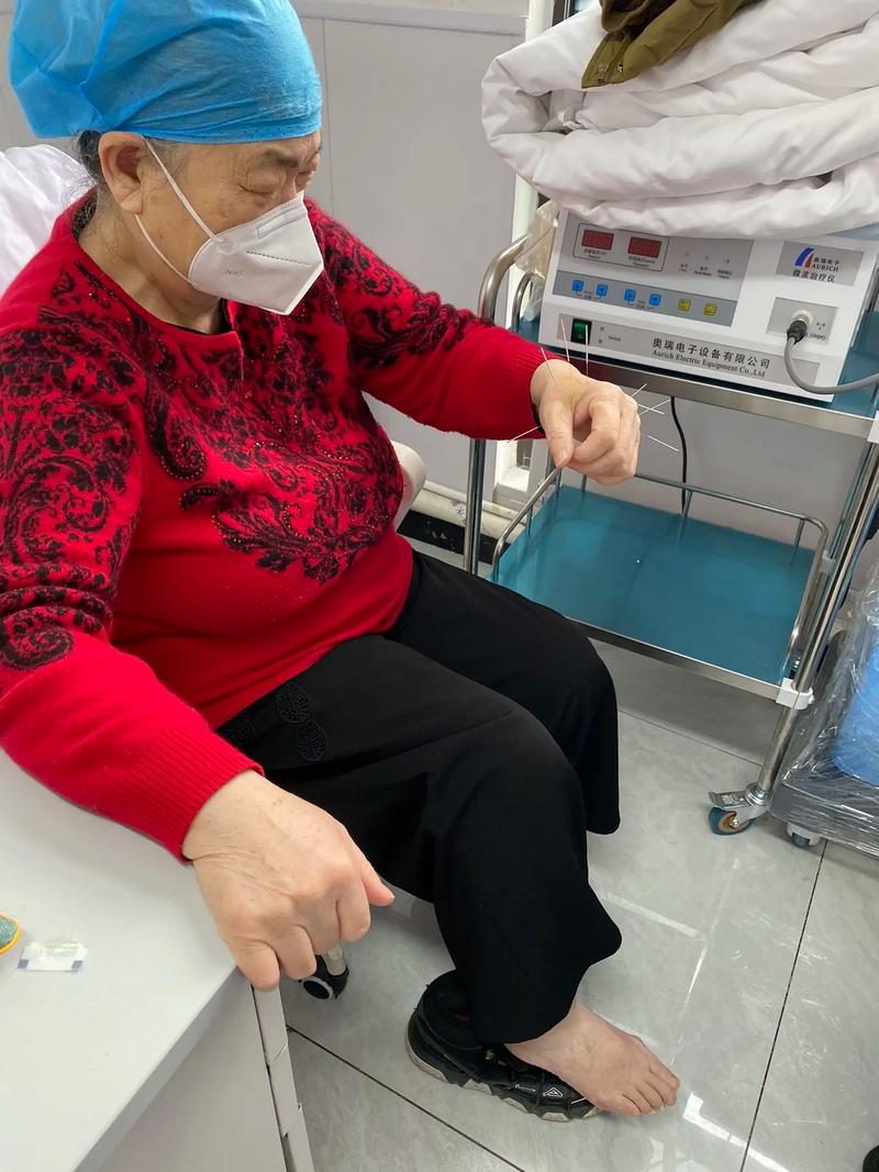 神经官能症针灸效果好