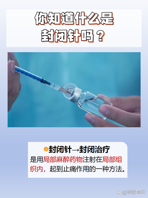 针灸后封针是什么意思