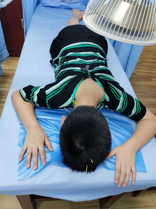 儿童抽动症针灸可以吗