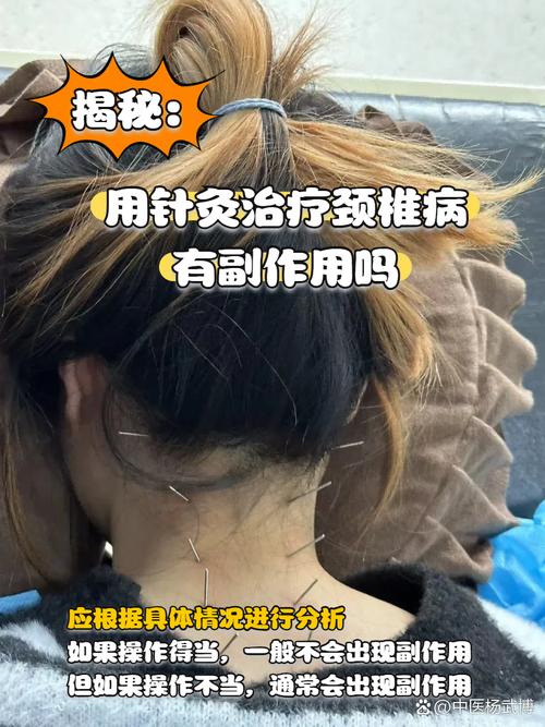 按摩针灸能治颈椎病吗