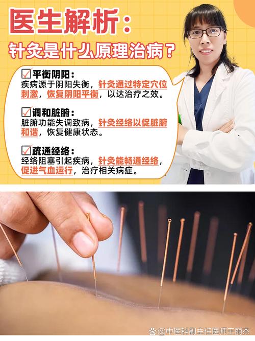 年轻人针灸对身体好吗