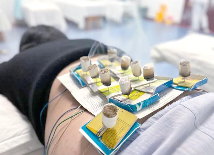 电灸和针灸哪个效果好