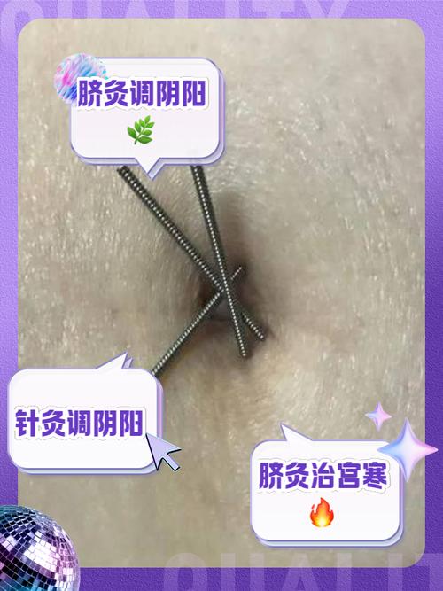 针灸腹部的作用是什么