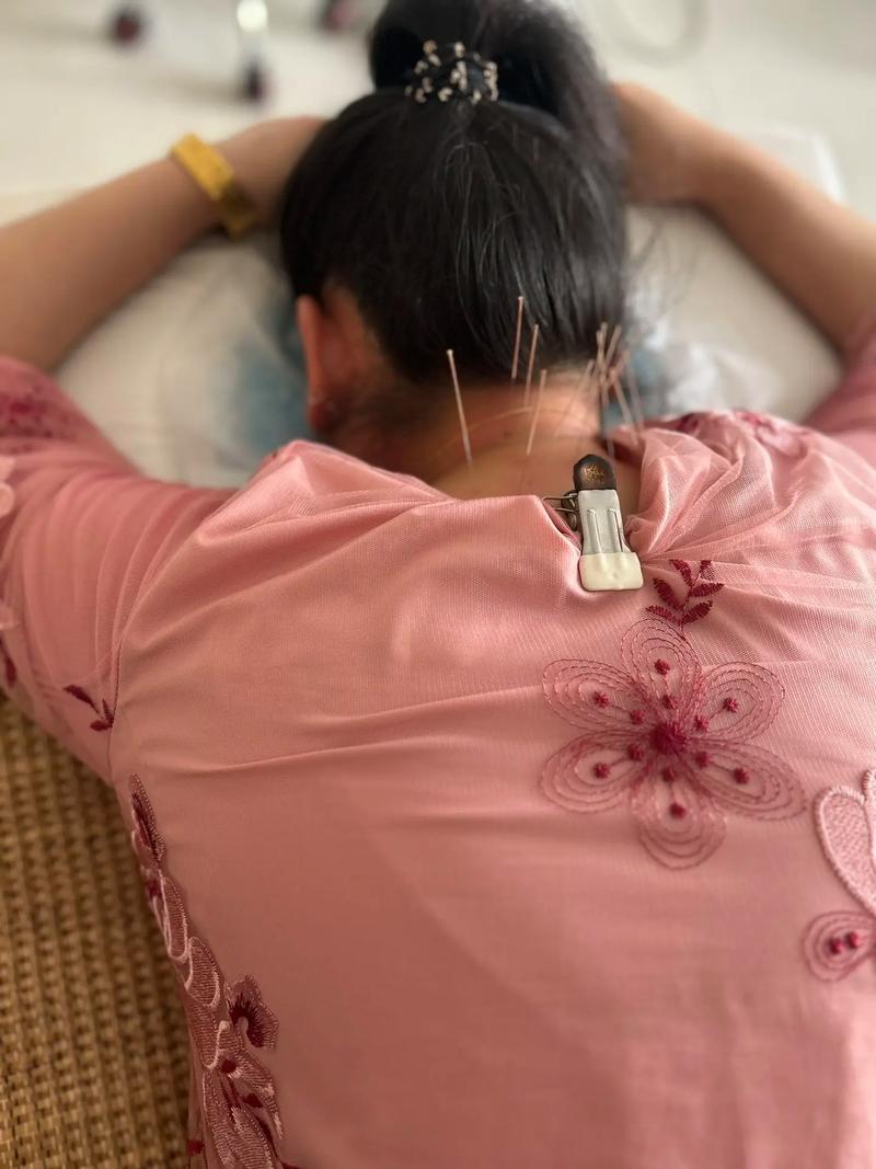 针灸后头晕恶心好几天