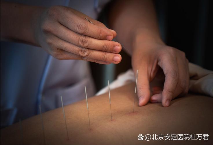 针灸治疗抑郁症易复发