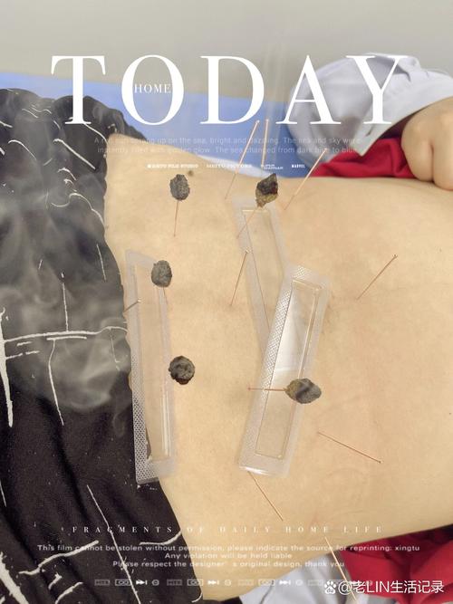 针灸来例假了还能灸吗