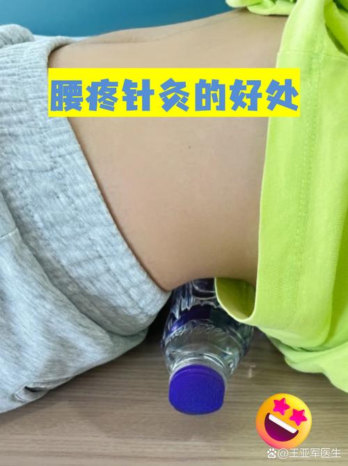 腰疼扎针灸有副作用吗