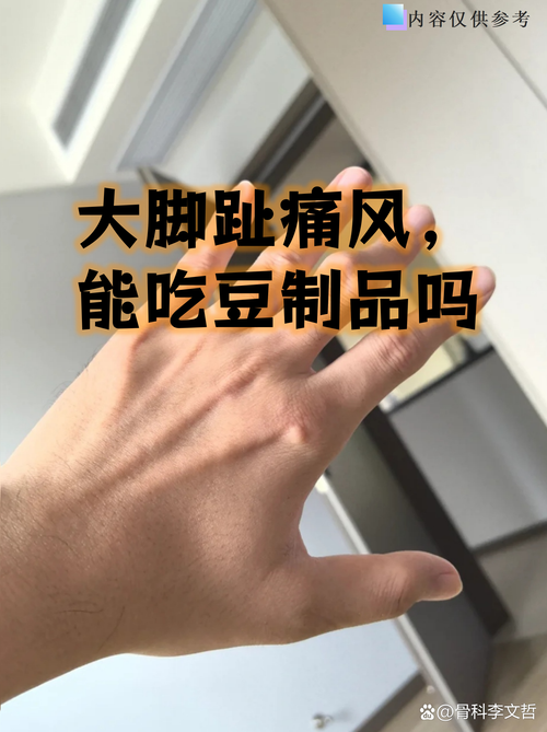 痛风患者可以吃胡豆吗