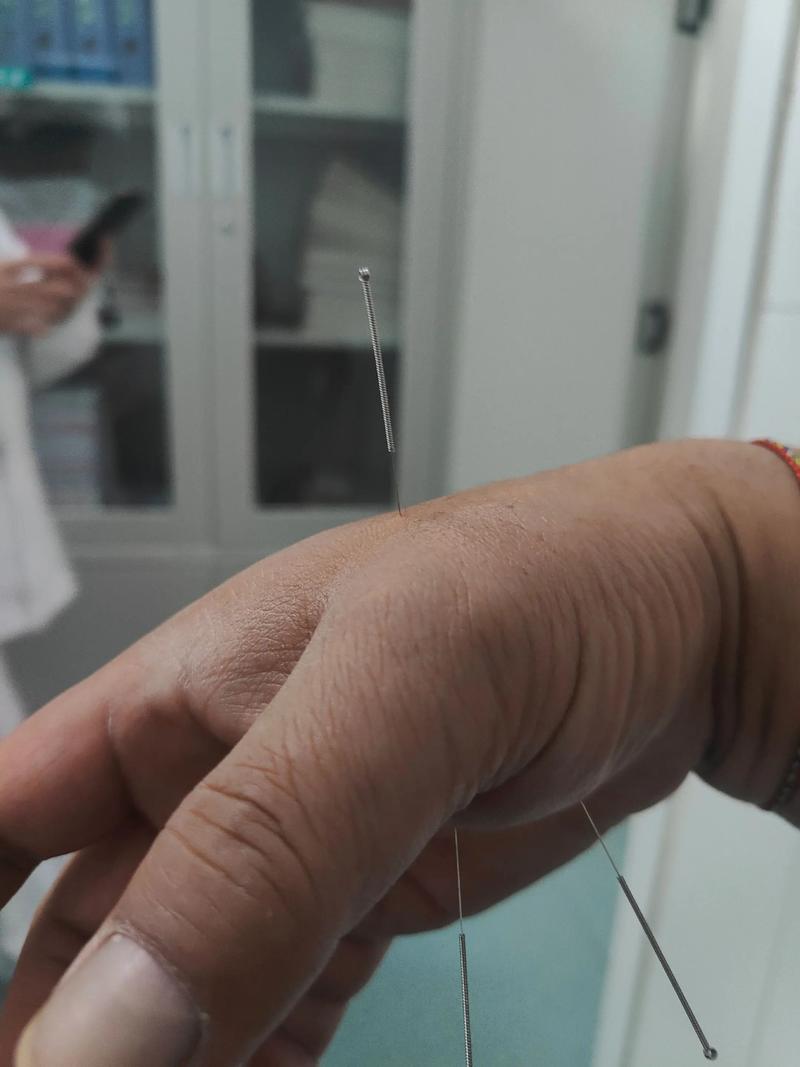 梦见扎针灸是什么意思