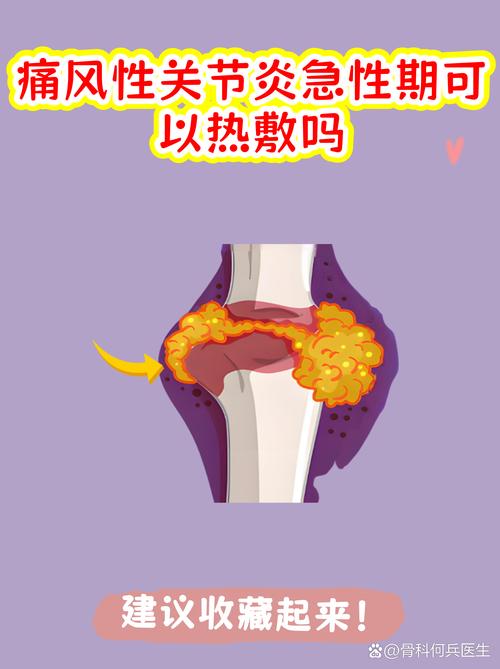 痛风脚疼热敷还是冷敷