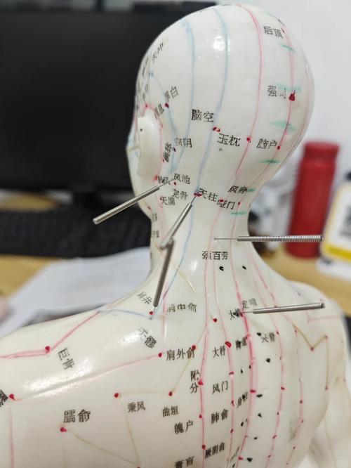 针灸头顶后的不良后果