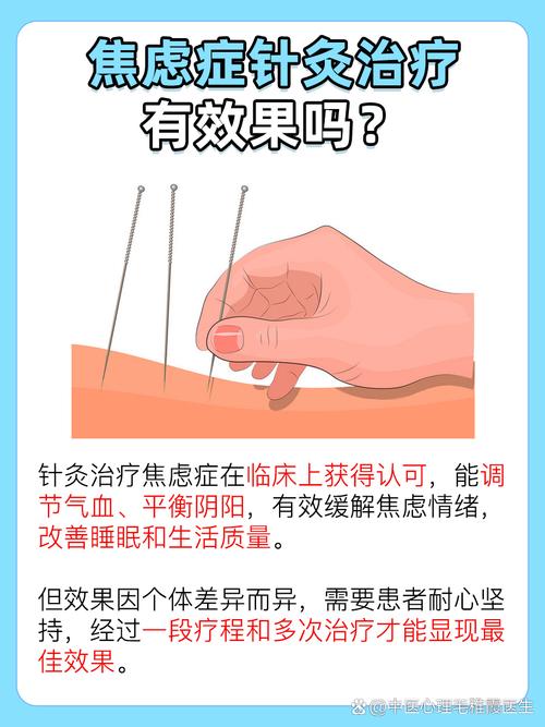 针灸可以治疗焦虑症吗