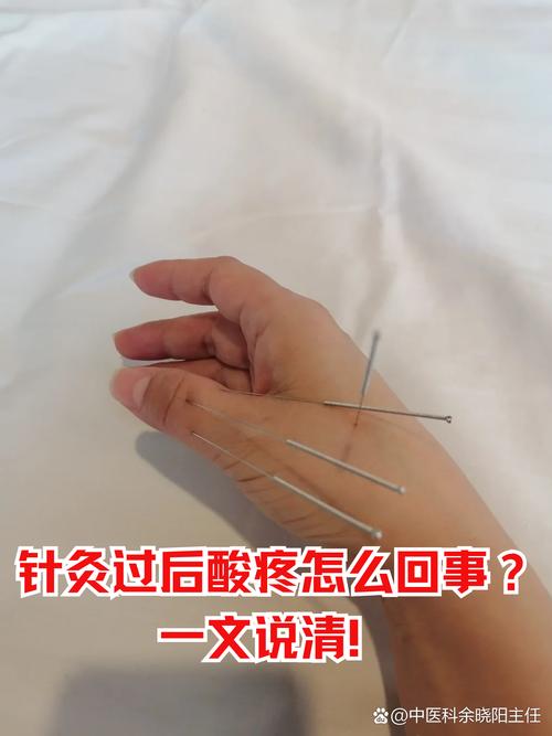 针灸后为什么会感觉累