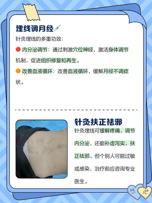 中医针灸埋线的副作用